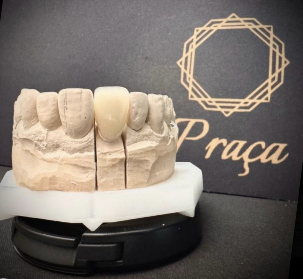 Coroas Dentárias em Vila do Conde | Centro Dentário da Praça