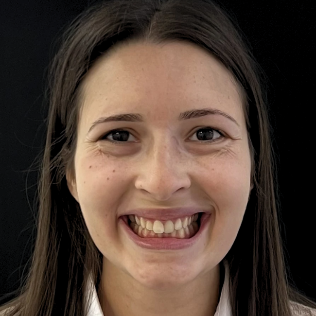 Antes: má oclusão com impacto na estética do sorriso em contexto social e profissional | Centro Dentário da Praça, Vila do Conde

